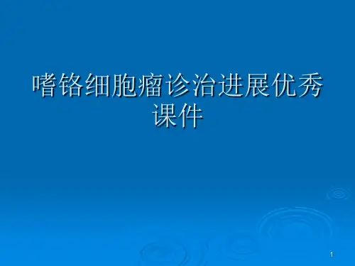嗜铬细胞瘤诊治进展优秀课件