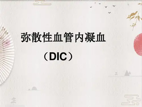 【凝血】DIC