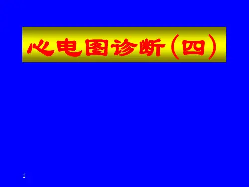心电图基础教学ppt课件