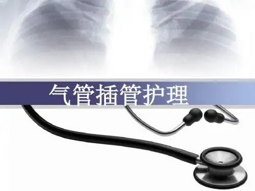 气管插管护理