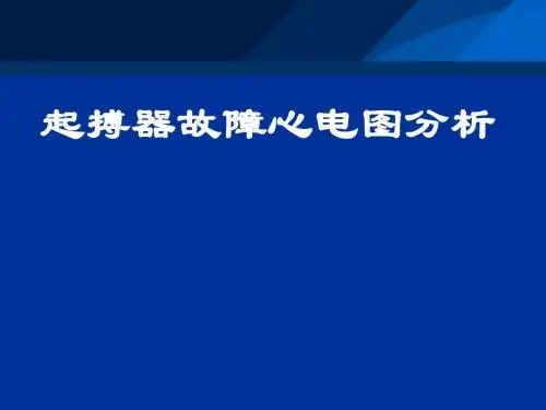 起搏器故障心电图分析