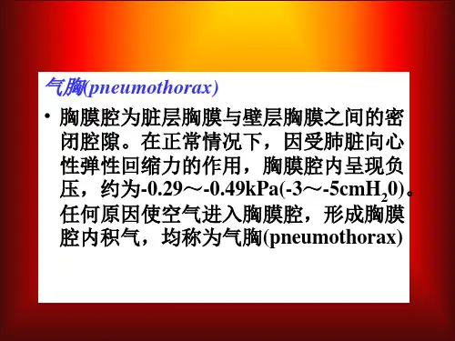 气胸 ppt课件25页PPT