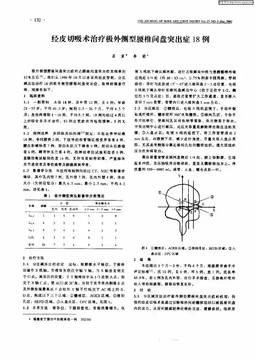 经皮切吸术治疗极外侧型腰椎间盘突出症18例
