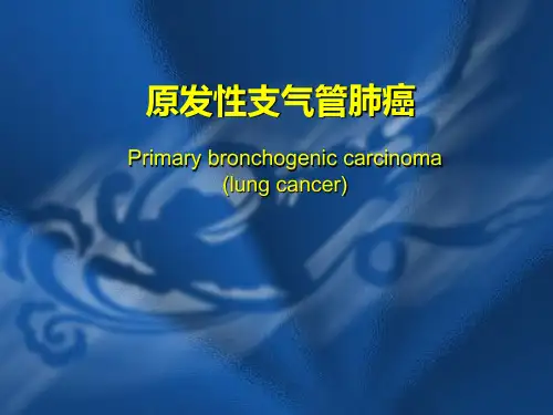 肺癌原理