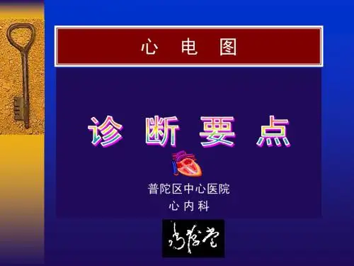 常见心电图诊断要点