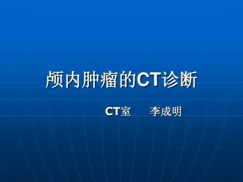 颅内肿瘤CT诊断
