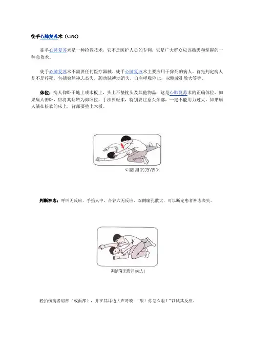 徒手心肺复苏