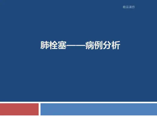 肺栓塞病例分析最新版本