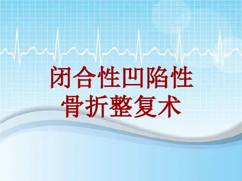 手术讲解模板：闭合性凹陷性骨折整复术