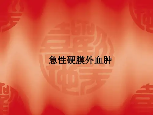 急性硬膜外血肿ppt课件