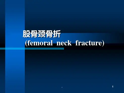 股骨颈骨折〖精品〗ppt课件