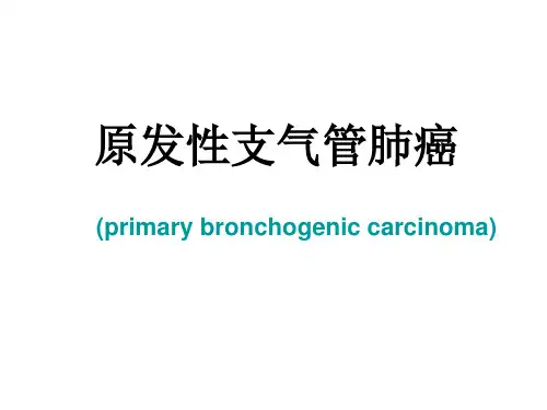 肺癌的治疗模板
