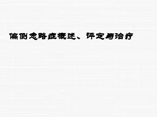 单侧忽略症