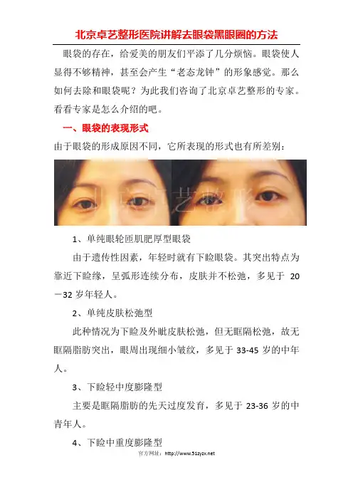 去眼袋黑眼圈的方法