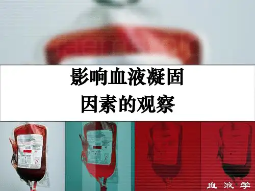 血液凝固1