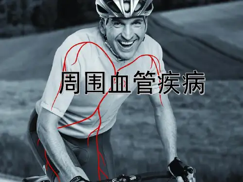周围血管疾病的诊治及护理