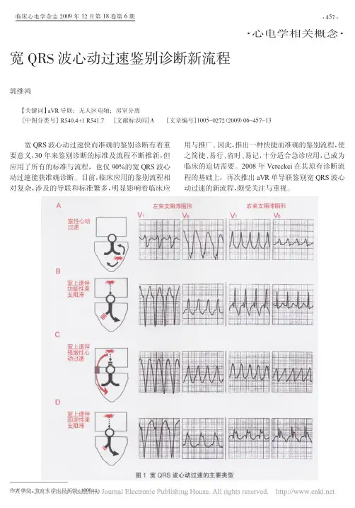 宽QRS波心动过速鉴别诊断新流程_郭继鸿
