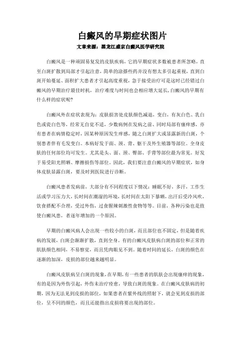 白癜风的早期症状图片