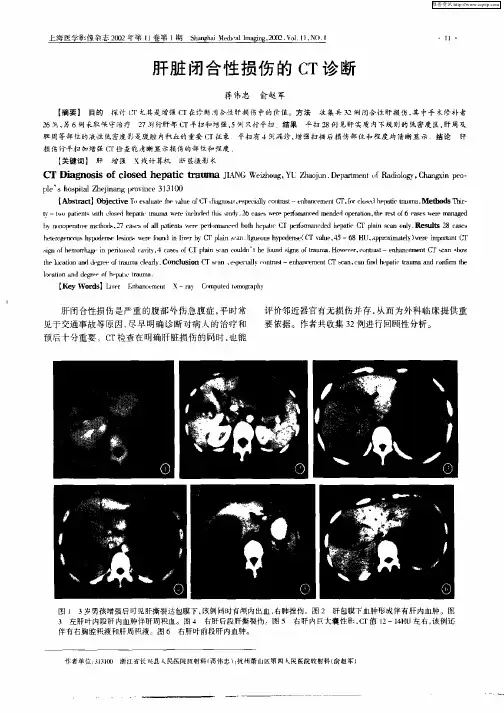 肝脏闭合性损伤的CT诊断