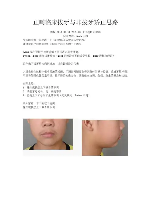 【正畸临床拔牙非拔牙思路】