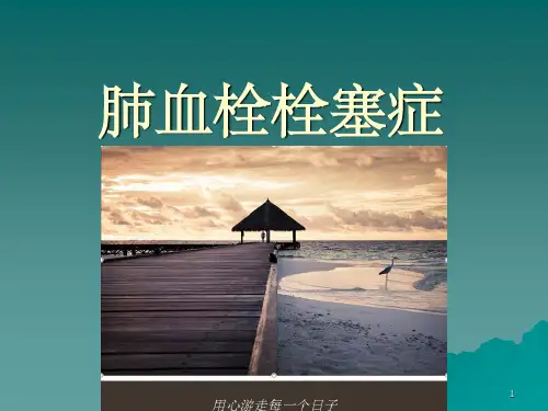肺栓塞最新指南