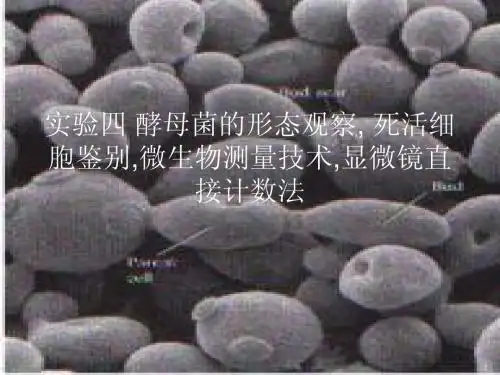 实验四 酵母菌的形态观察, 死活