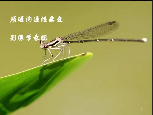 颅眶沟通性病变