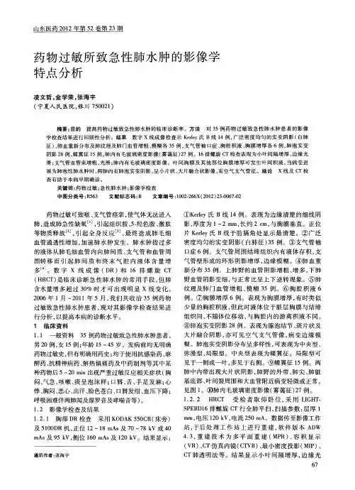 药物过敏所致急性肺水肿的影像学特点分析