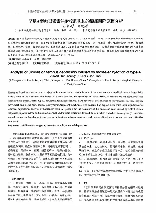 罕见A型肉毒毒素注射咬肌引起的颞部凹陷原因分析