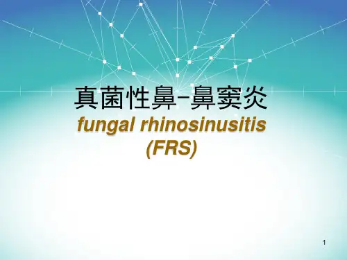 真菌性鼻鼻窦炎PPT课件