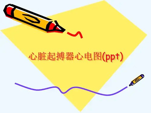 心脏起搏器心电图(ppt)