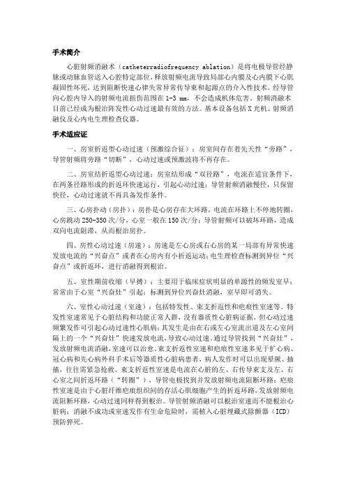 射频消融术
