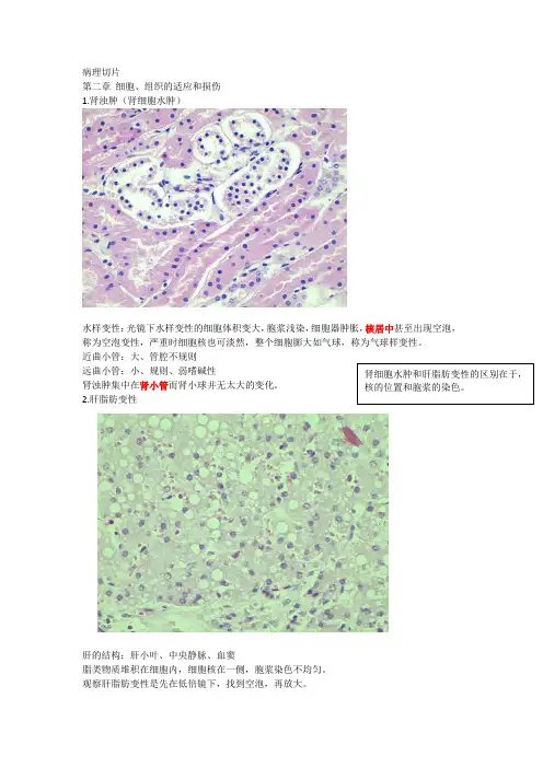 病理切片