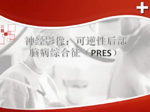 神经影像：可逆性后部脑病综合征(PRES)