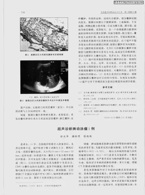 超声诊断脾动脉瘤1例