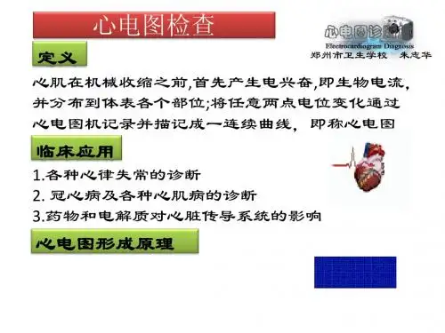 心电图检查