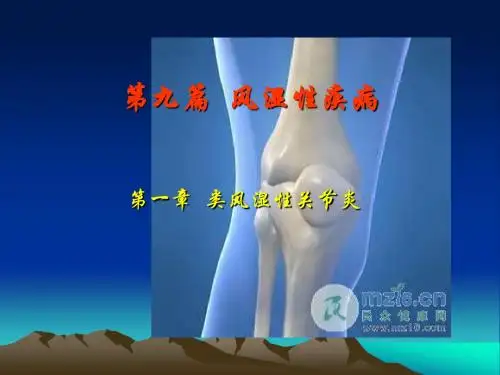33类风湿性关节炎