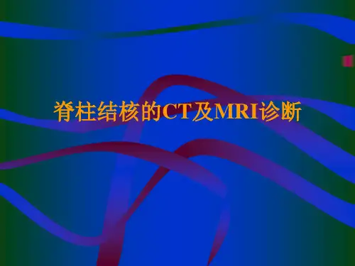 影像学,脊柱结核的CT及MRI诊断