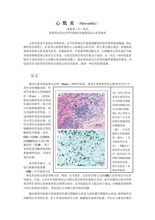 心肌炎