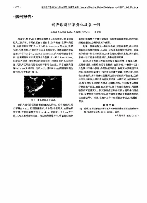 超声诊断卵巢黄体破裂一例