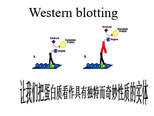 Western_blot原理和技术