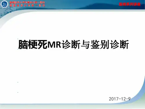 脑梗死MR诊断及鉴别诊断