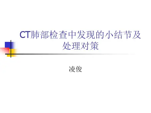 CT肺结节及处理对策