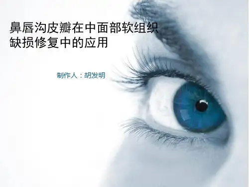 鼻唇沟皮瓣的应用
