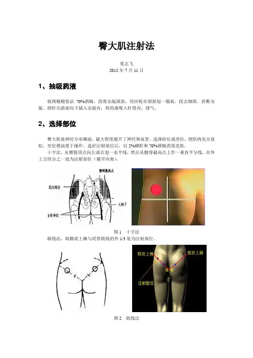 臀大肌注射法(20150711)