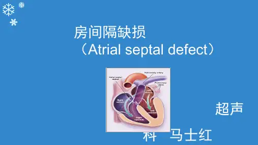 房间隔缺损PPTPPT课件