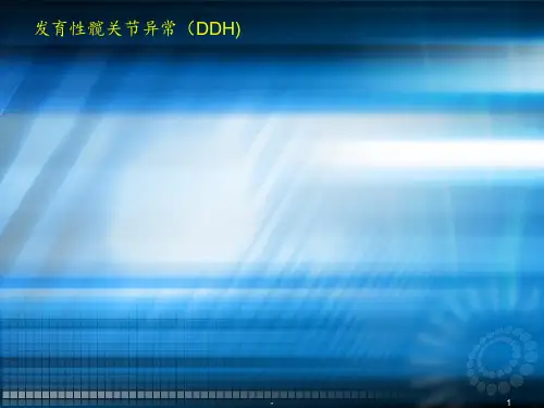 发育性髋关节异常ppt课件
