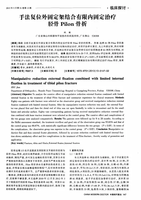 手法复位外固定架结合有限内固定治疗胫骨Pilon骨折