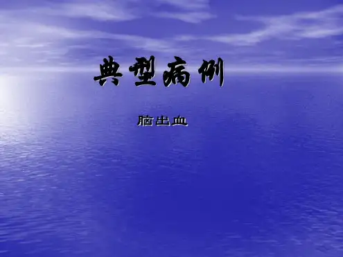 典型病例脑出血PPT课件.pdf