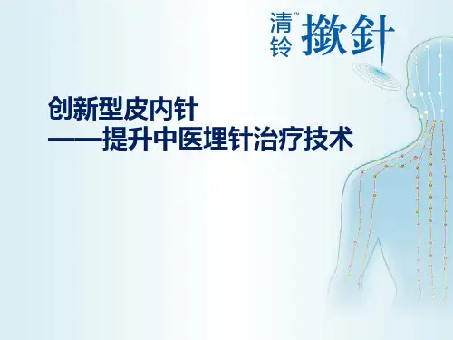 创新型皮内针PPT演讲(通用型)教学文案
